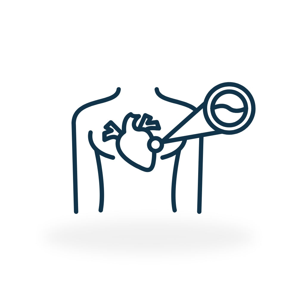 Coronary Calcium Scan
